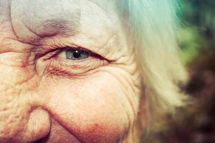 Wrinkles Treatment Natural Remedies