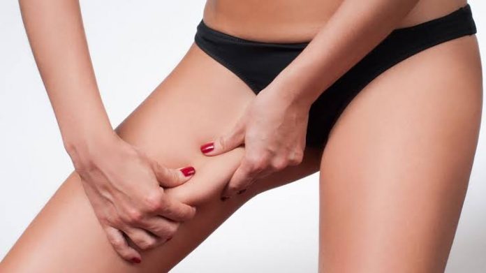 Coolsculpting for Thighs